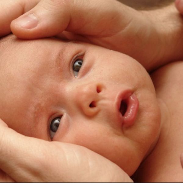 Torcicollo miogeno nei  neonati