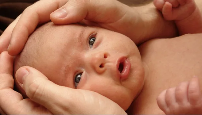 Torcicollo miogeno nei  neonati