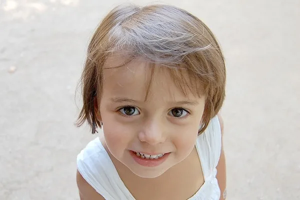 Rottura dentino da latte: cosa fare?