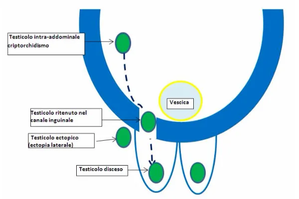 chiptorchidismo-articolo-benvenuti-per-bresciabimbi